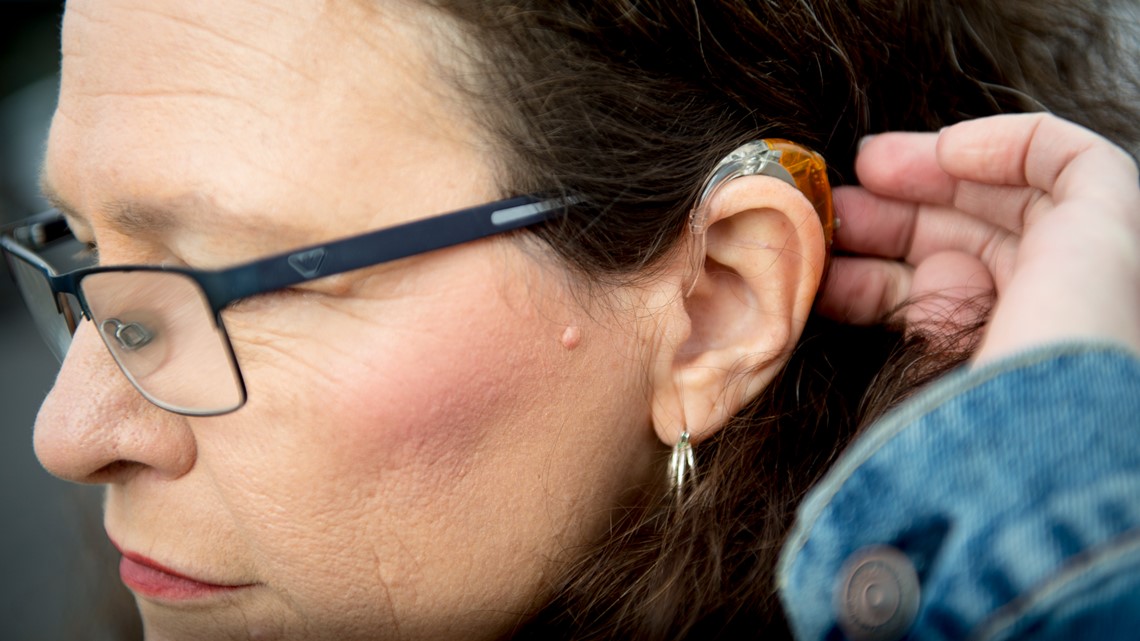 FDA proposes hearing aids over-the-counter to cut costs