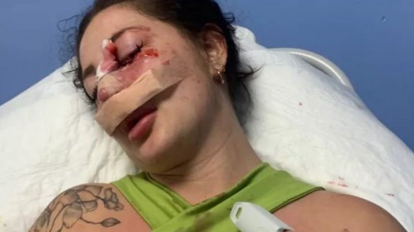 Girl who’d been stalked in Vancouver is brutally attacked in Mexico