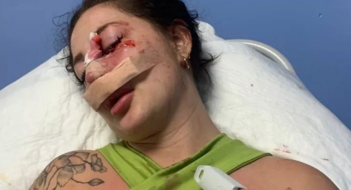 Girl who’d been stalked in Vancouver is brutally attacked in Mexico