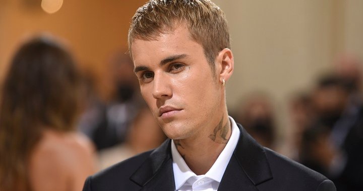 Justin Bieber says he has facial paralysis as a result of Ramsay Hunt syndrome