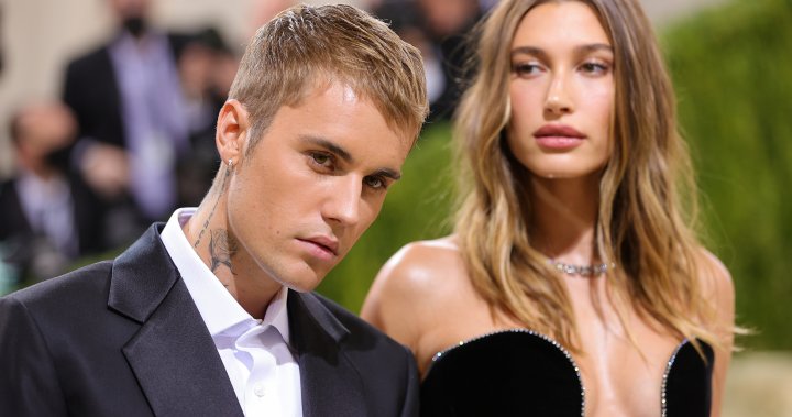 Hailey Bieber shares replace on Justin Bieber’s facial paralysis scare – Nationwide