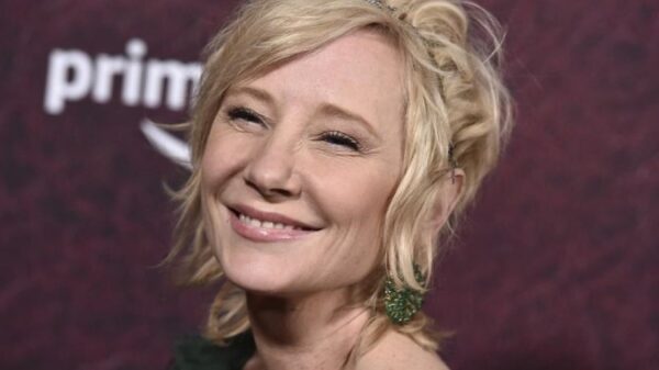 Anne Heche’s demise dominated an accident by coroner following automotive crash – Nationwide