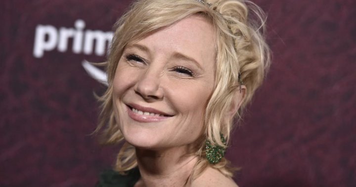 Anne Heche’s demise dominated an accident by coroner following automotive crash – Nationwide