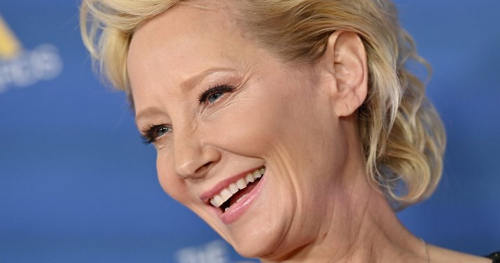 Anne Heche in coma following automobile crash, stays in vital situation – Nationwide