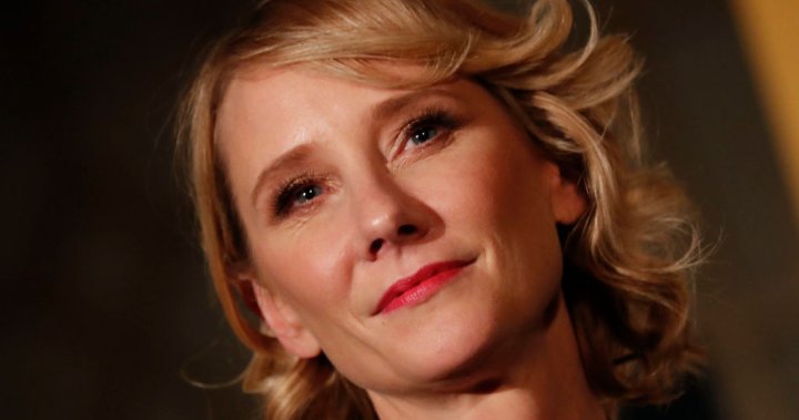 Anne Heche dying: Horrific particulars revealed in firefighter radio recordings – Nationwide
